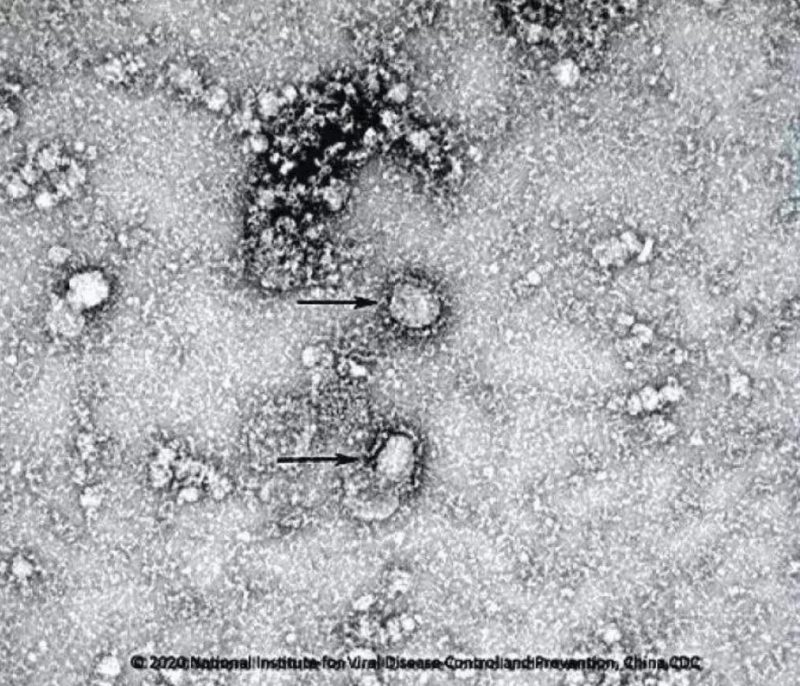▲新型冠狀病毒武漢株01。照片來源：國(guó)家病原微生物資源庫(kù)（中國(guó)疾病預(yù)防控制中心病毒病預(yù)防控制所）